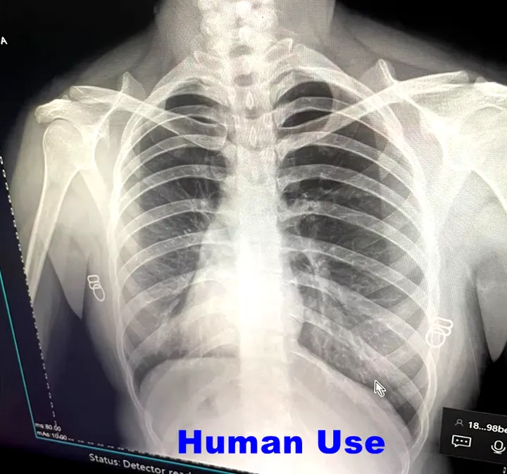 14x17 Inch High Resolution Veterinary Medical. جهاز تصوير بالأشعة السينية لاسلكي عالي الدقة 14 × 17 بوصة
